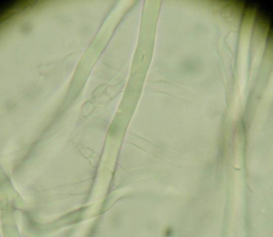 Da determinare (Antrodia albida)